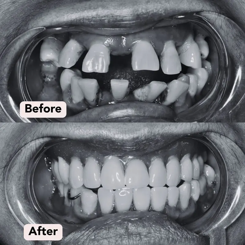 B w dentures before after
