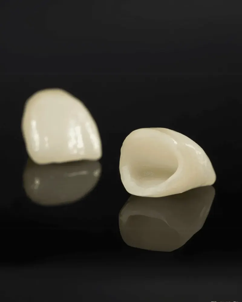 Porcelain crown caps