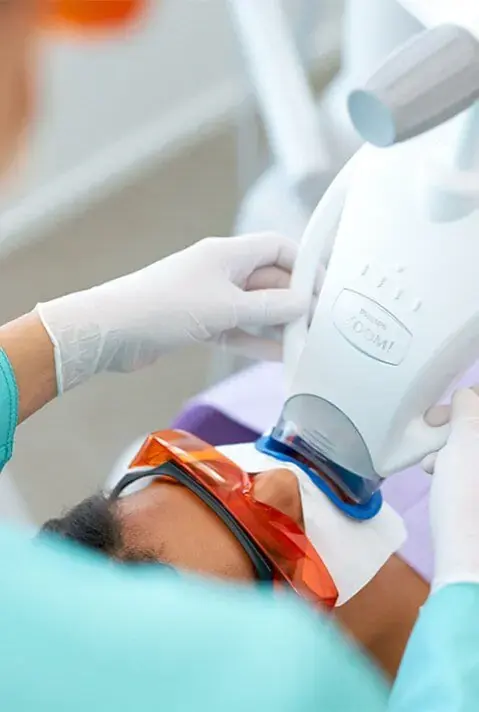 Zoom whitening